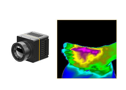 Ongekoelde Thermische Module384x288 17μM For Thermographic Medical Gezondheidszorg